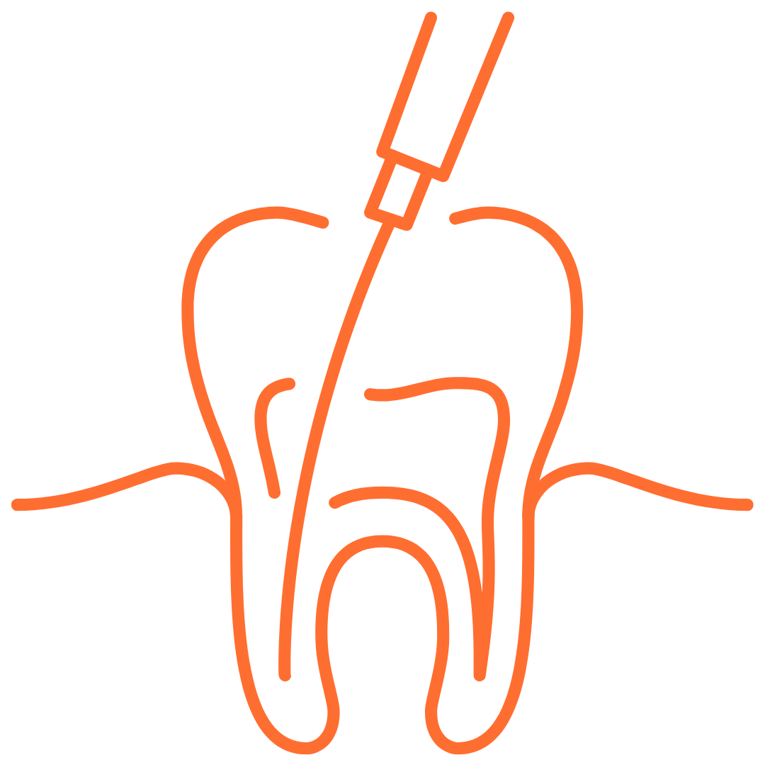 Endodontie - Zahnarztpraxis MundArt Klein-Gerau